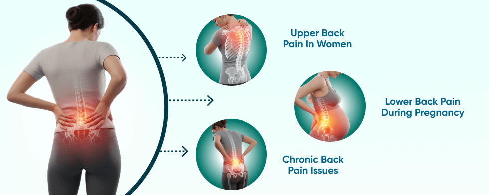 Types of Back Pain in Women