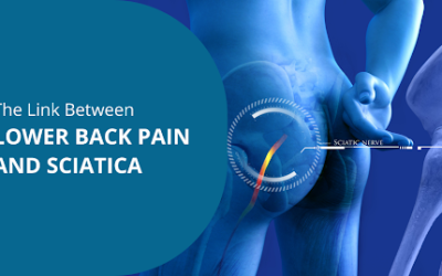 The Link Between Lower Back Pain and Sciatica