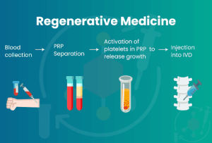 Regenerative Medicine