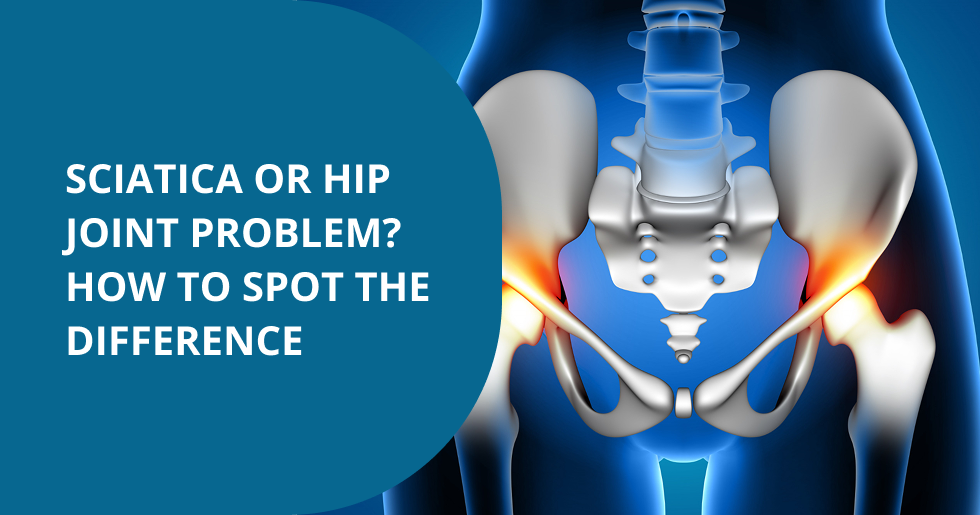 Sciatica or Hip Joint Problem? How to Spot the Difference