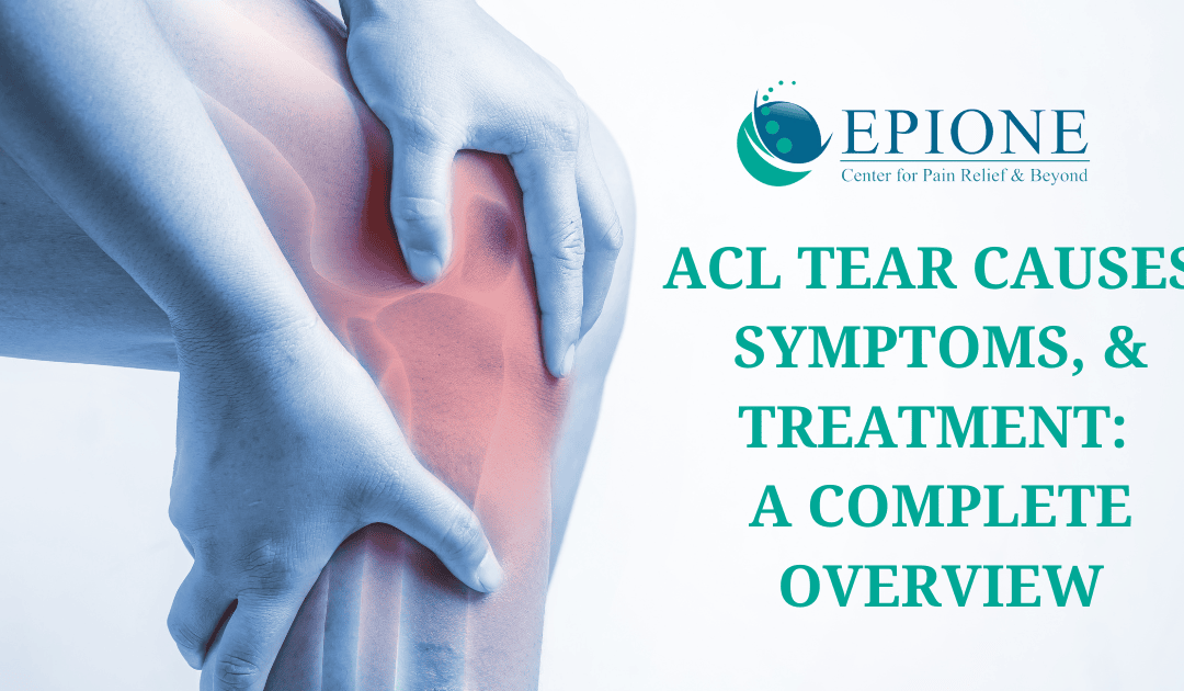 ACL Tear Causes, Symptoms, and Treatment: A Complete Overview