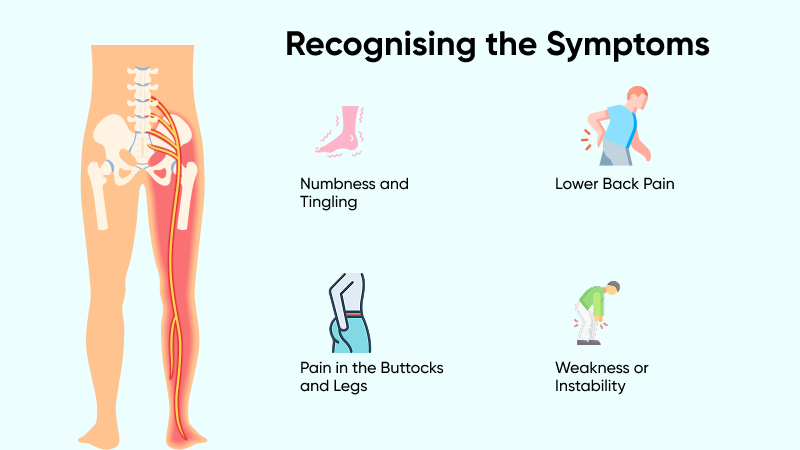 Sciatica Symptoms and Causes