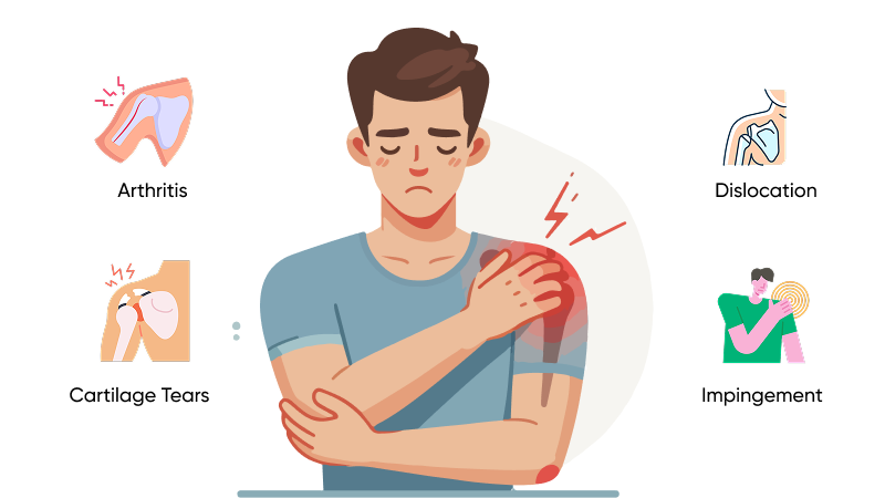 Causes of Shoulder Pain | What Doctor Should I See for Shoulder Pain