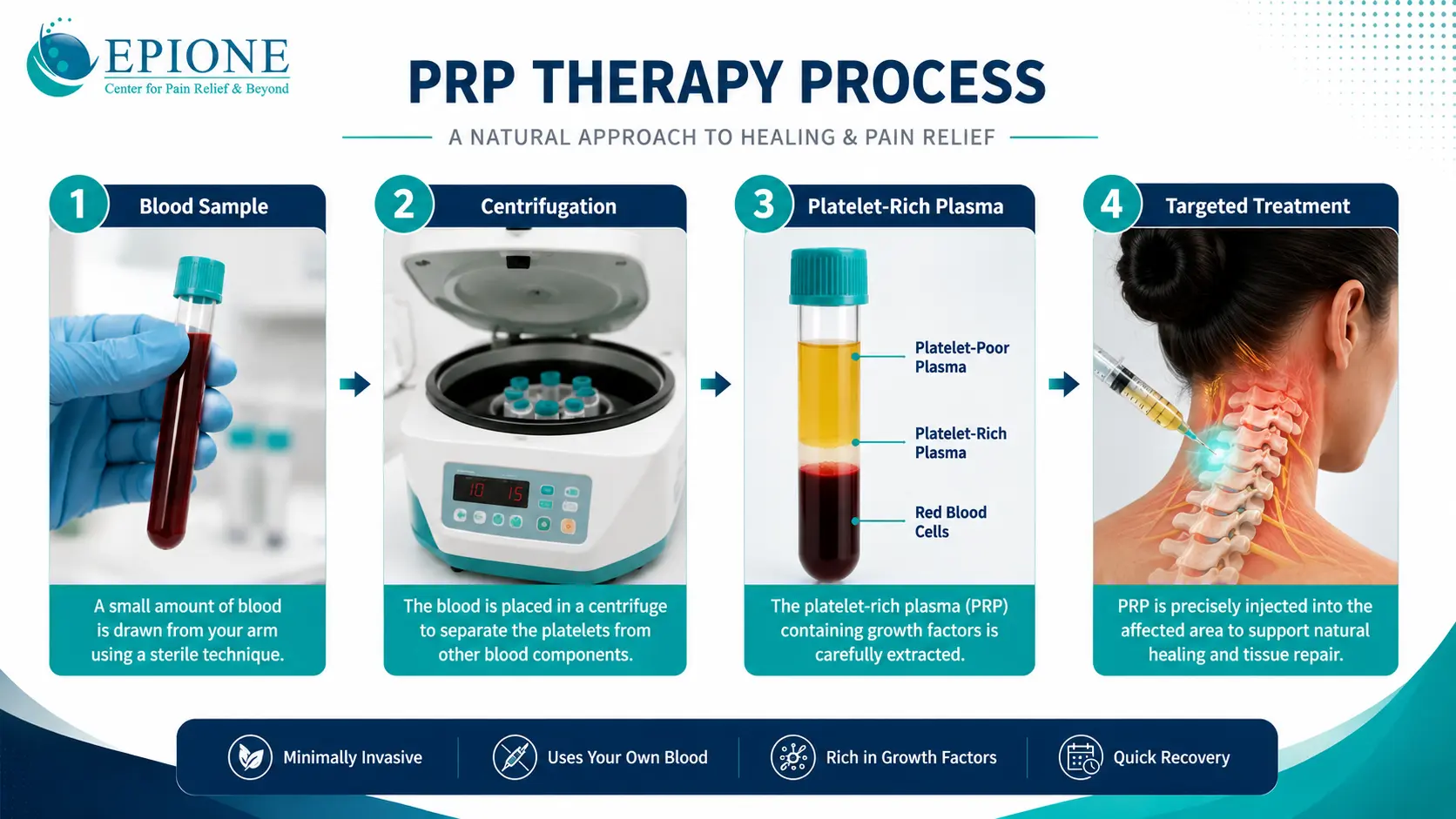 Infographic showing the basic PRP therapy preparation and treatment process