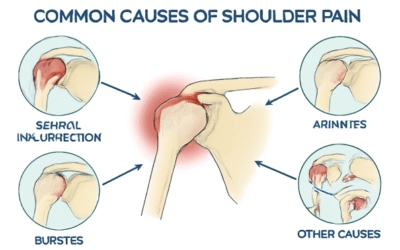 Why Your Shoulder Hurts: Causes & Solutions