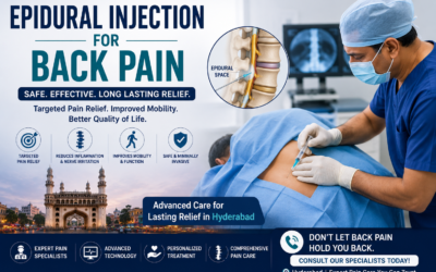Epidural Injections for Back Pain: What to Expect
