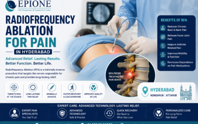 What Is Radiofrequency Ablation (RFA)? A Patient’s Guide